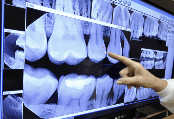 emergency dentist in pasadena