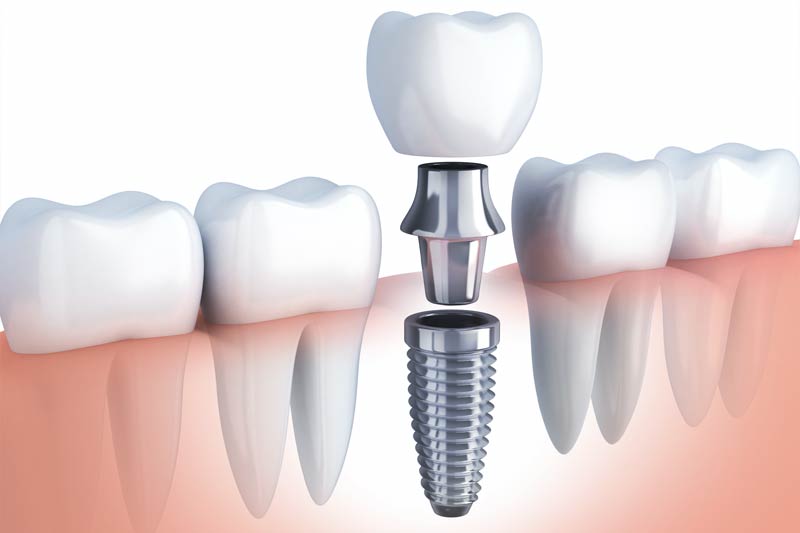 Signature Smiles|SPECIAL OFFERS