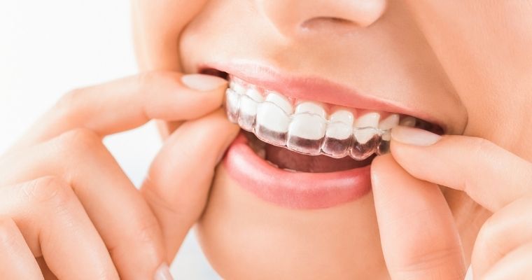 orthodontics