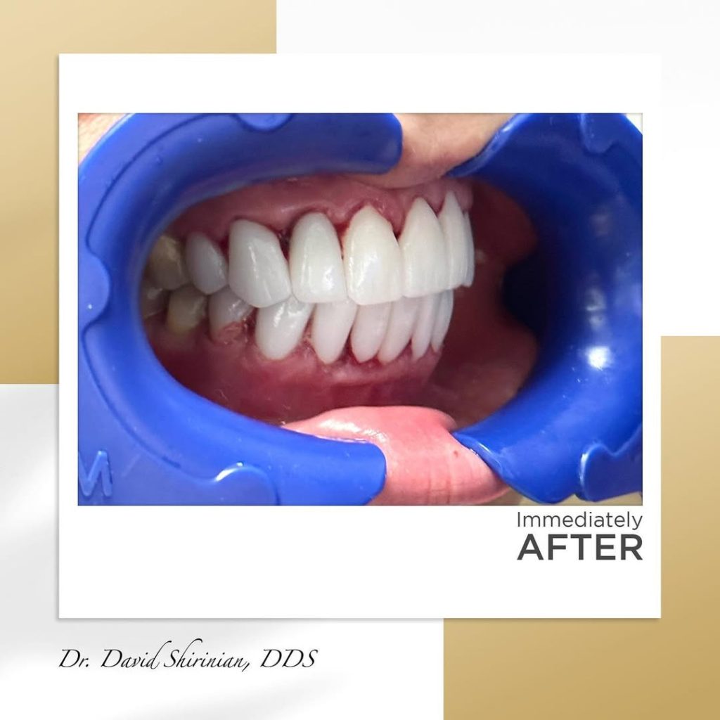 Signature Smiles|BEFORE / AFTERS