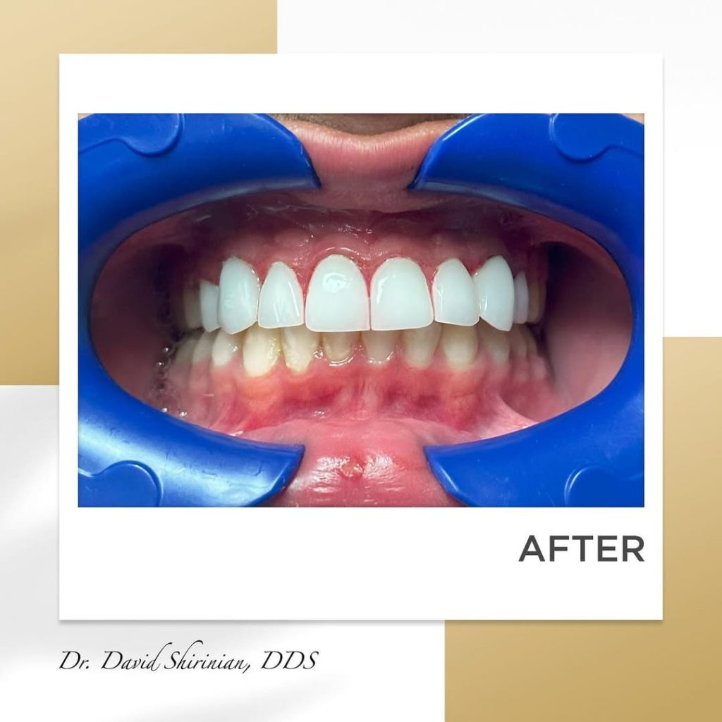 Signature Smiles|BEFORE / AFTERS
