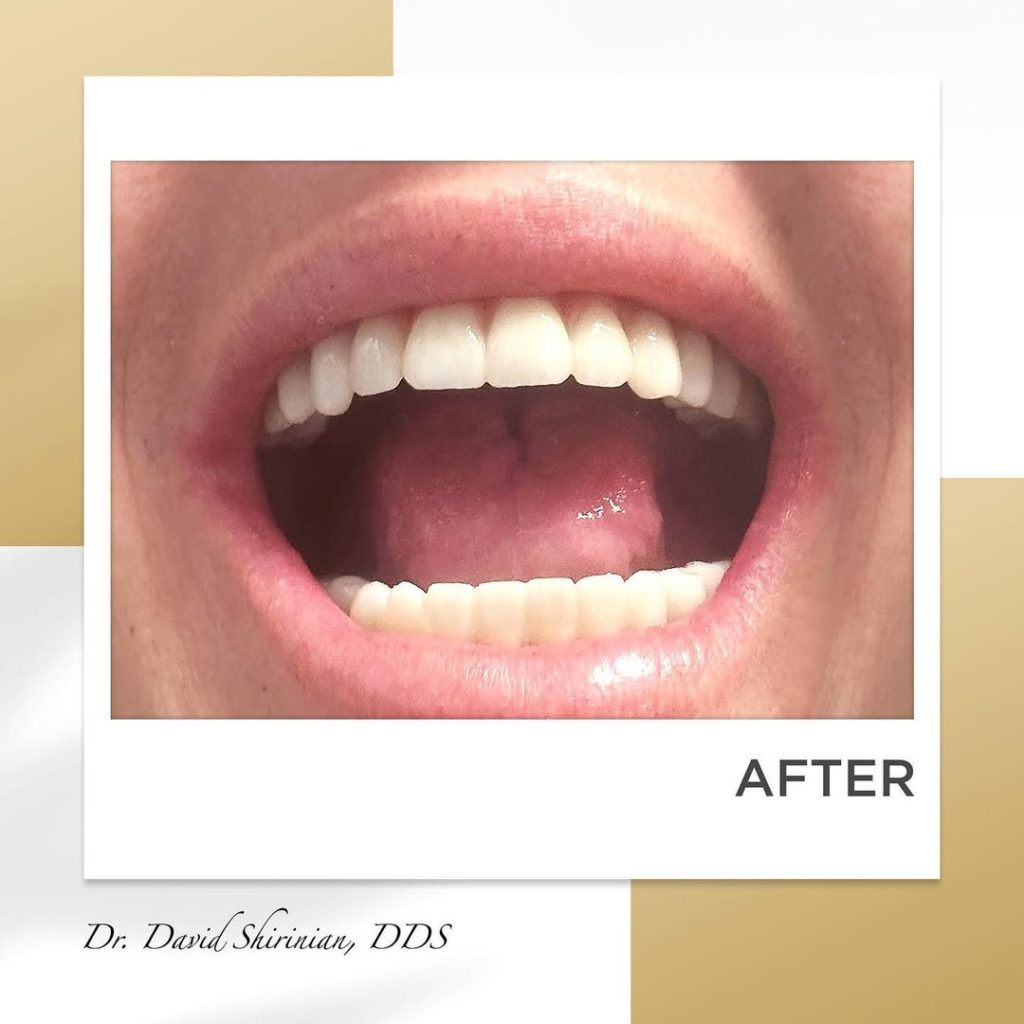 Signature Smiles|BEFORE / AFTERS
