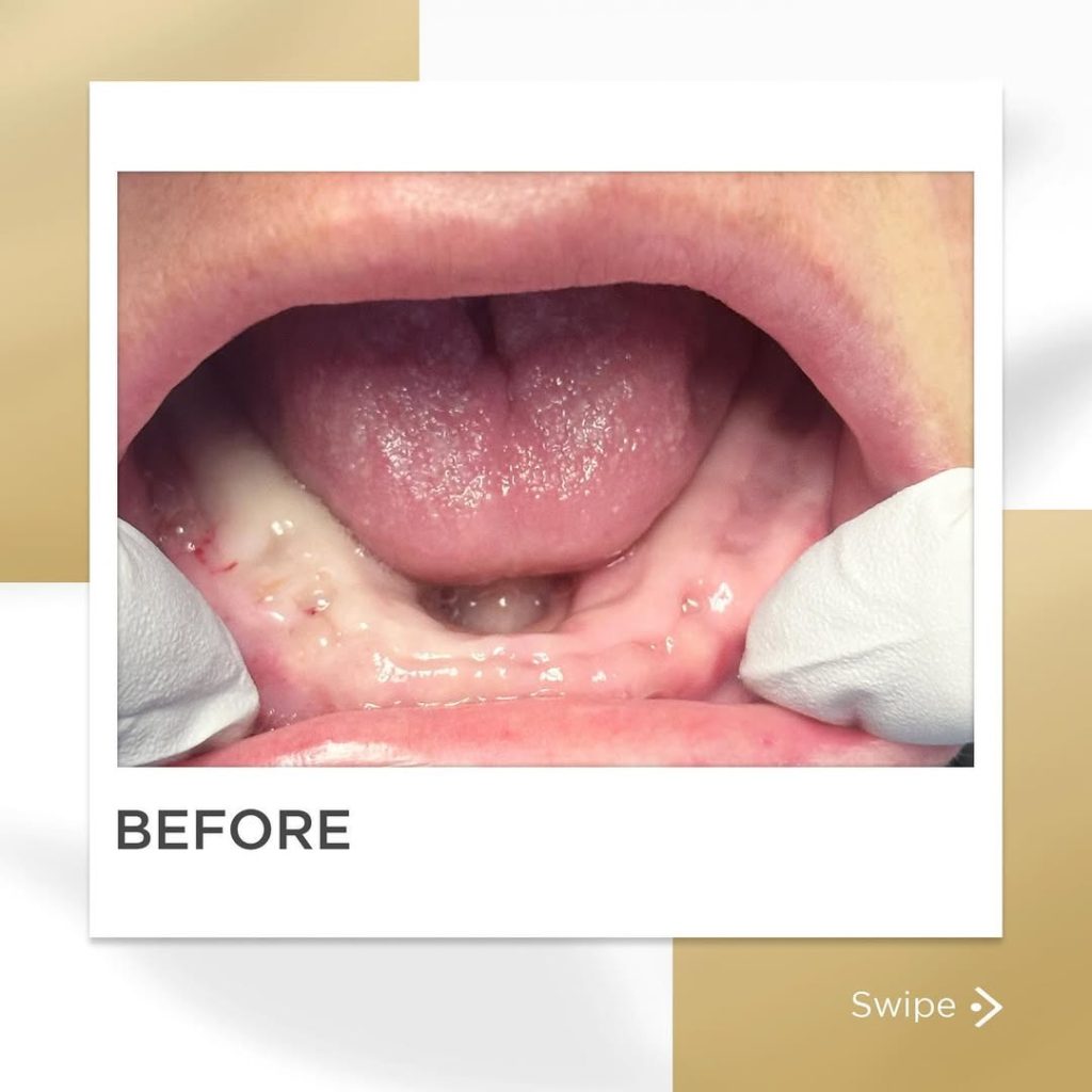 Signature Smiles|BEFORE / AFTERS